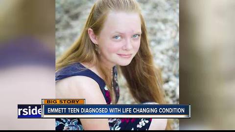 Emmett teen diagnosed with scoliosis hopes for innovative surgery