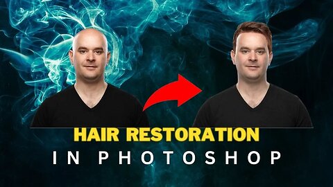 How To Do Perfect Hair Transplant In Photoshop | Adobe Photoshop Tutorial | Hair Restoration