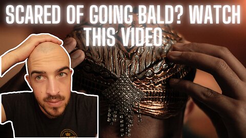 Don't Be Scared To Go Bald