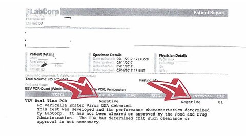 Varicella Zoster Virus (Shingles) NEGATIVE PCR Test Following Scalar Light Sessions