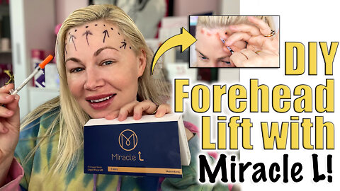 DIY Forhead Lift with Miracle L from Acecosm.com | Code Jessica10 Saves you Money!