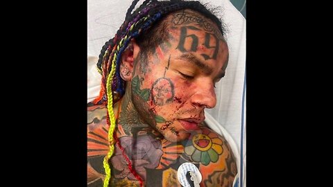 TEKASHI 6IX9INE BRUTALLY ATTACKED IN FLORIDA GYM