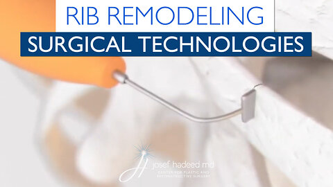 Rib Remodeling Technologies