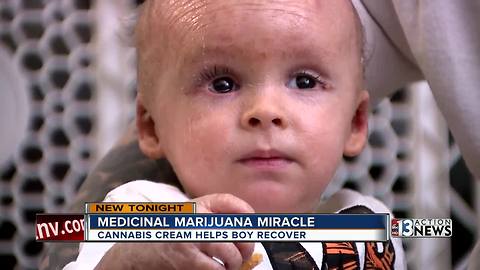 Medicinal marijuana miracle