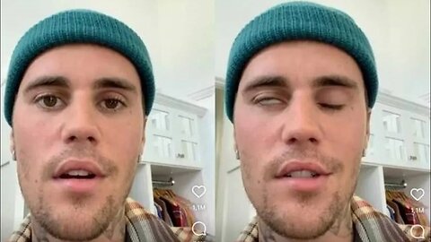 COM PARALISIA FACIAL, JUSTIN BIEBER PEDE ORAÇÃO E DIZ QUE ESTÁ SE APOIANDO NA FÉ