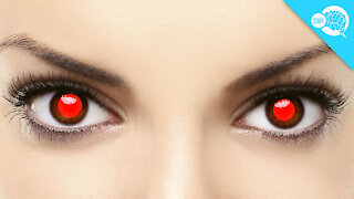 BrainStuff: What Causes Red Eye In Photos?