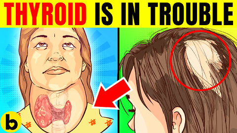 14 Early Warning Signs Your THYROID Is In Trouble