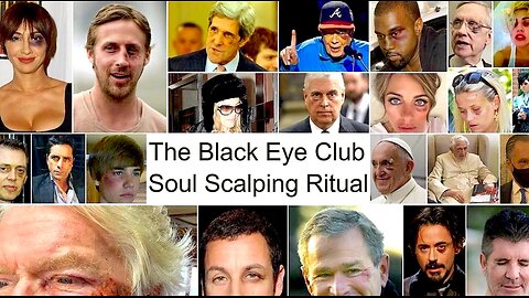 The Black Eye Club