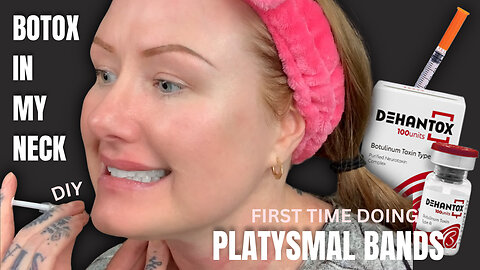 DIY BOTOX - PLATYSMAL BANDS (AceCosm.com code NISA10)