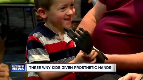 Three kids given new prosthetic hands