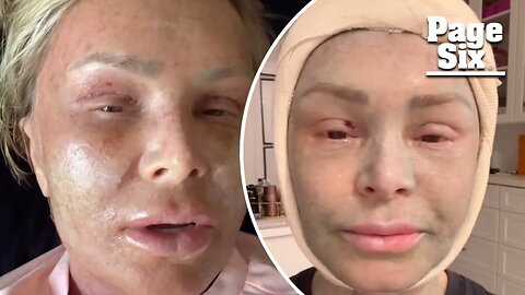 Tamra Judge savagely roasted by mom over plastic surgery recovery: 'Your face literally makes me want to throw up'