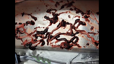 Self Assembling Nanotechnology Blood 🩸 Clots In Cadavers