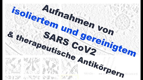 Aufnahmen von isoliertem und gereinigtem SARS CoV2