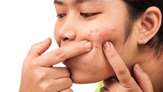 Remoção de Cravos e Espinhas - Remove Squeezing Blackheads and Pimples - Just Relax | Apenas Relaxe