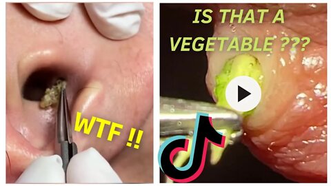 BLACKHEADS & INGROWN HAIR Removal tiktok COMPILATION