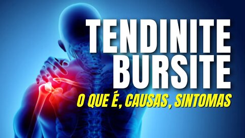 Tendinite - O Que é Tendinite e Bursite