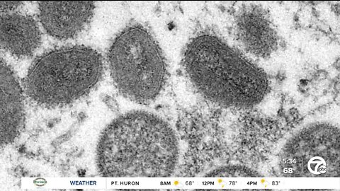 State monitoring increase in COVID-19 & monkeypox cases