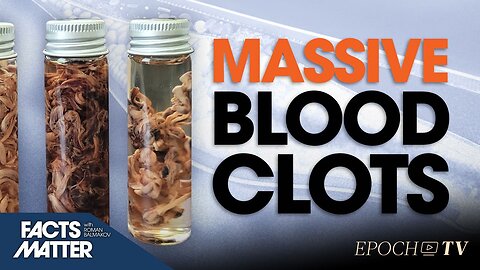 Truth Behind Spike Protein Causing Massive Blood Clots | Facts Matter