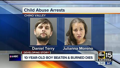 Child dies after being beaten, burned and bound in Chino Valley