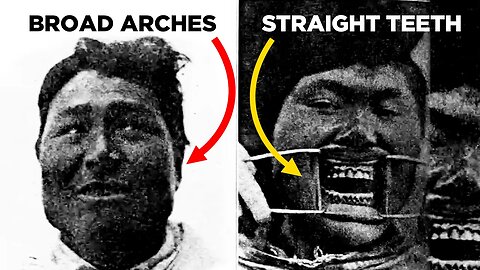 Why 95% of the people used to have straight teeth. Lecture by Dr Mew - critique by Dr McIntosh (ENT)