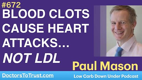 PAUL MASON 1a | BLOOD CLOTS CAUSE HEART ATTACKS…NOT LDL