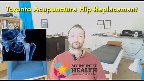 TORONTO ACUPUNCTURE - For Hip replacement