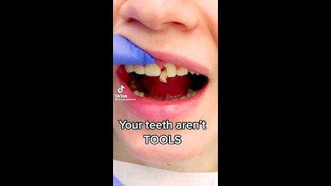 Your teeth aren't tools