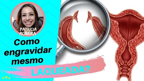 LAQUEADA, quais as chances para engravidar? | Patrícia Moreira