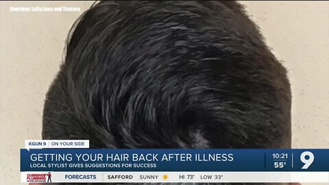 Getting your hair back after losing it to COVID and other medical issues