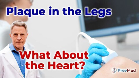 Plaque in the legs; What about the heart?