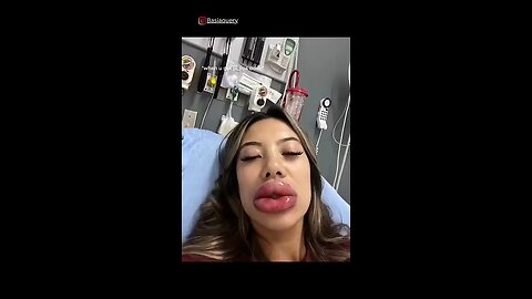 big Lip's girl 😂🤣 | funny thing