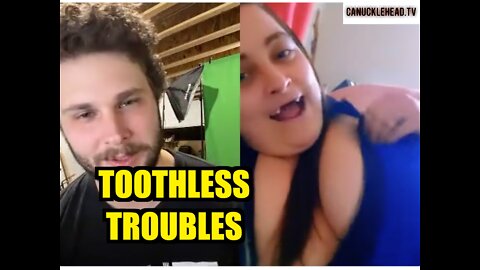 TikTalks: Toothless Troubles