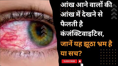 EYE FLU आँखों में देखने से फैलता है , कितना सच है यह ? | CONJUCTIVITIS | EYE INFECTION | PINK EYES