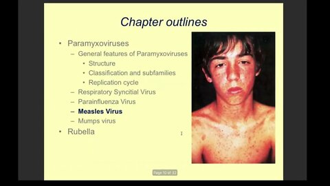 Rubella and Paramyxo Virus Lecture