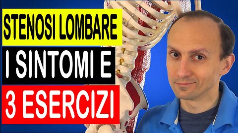 Stenosi Lombare: i Sintomi e i 3 Esercizi Migliori (Testati)