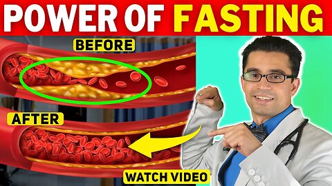 😱 ONE Secret TRICK to Cure High Blood Pressure: Can Intermittent Fasting treat High Blood Pressure?😱