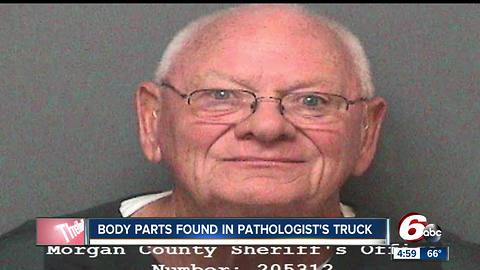 Human bones found in back of man's truck after OWI arrest