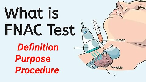 FNAC Test | Definition | Purpose | Procedure | Pathology