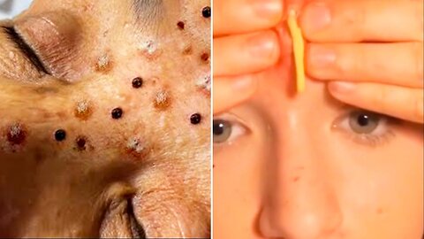 Massive Skin Explosion - Get Ready to Be Amazed!