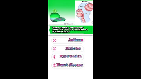 Nasal polyps question answer mcqs #shormcqs #Nasalpolyps #disease #breathing #medication