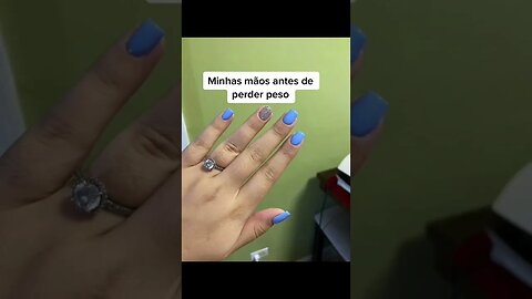 MINHAS MÃOS ANTES/DEPOIS DE PERDER PESO - Vídeos Tiktok #Shorts