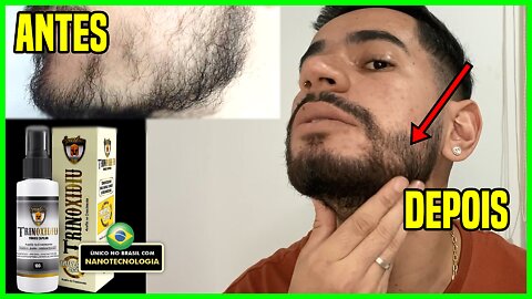 ✅ Trinoxidiu Funciona? Cresce Mesmo? Depoimento Masculino! Trinoxidiu a VERDADE