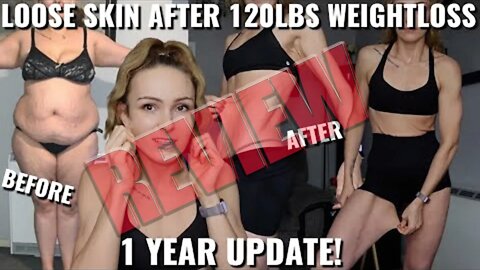 Loose Skin After Losing 120lbs LouisesJourneyxo Review Live 3/23/22 1 pm EST