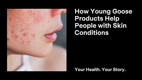 How Young Goose Products Help People with Skin Conditions