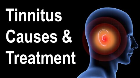 What is Tinnitus | Causes of Tinnitus | Treatment Strategies of Tinnitus