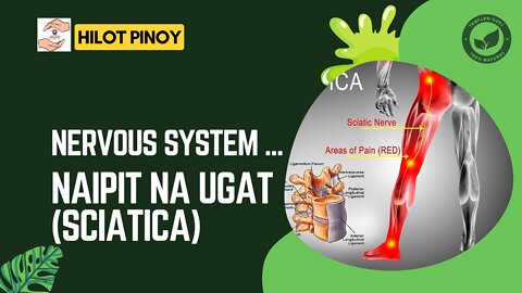 Nervous System ... Naipit na Ugat (sciatica)