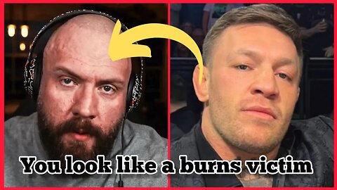 Conor McGregor Destroys True Geordie (you look like a burns victim mate) - BIG BEEF!!!!!