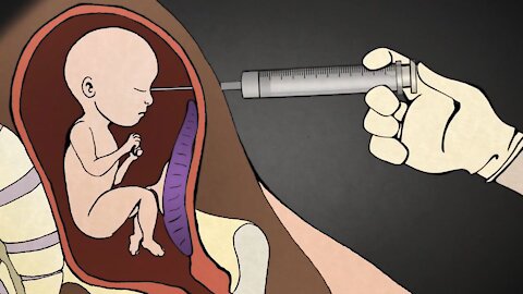 3rd Trimester Abortion via LETHAL Injection | Former Abortionist Dr. Anthony Levatino