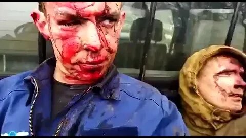 🇺🇦Graphic War 18+🔥Crashed Russian Pilots Ukraine Armed Forces Captured 2Ruski Injured Pilots #Shorts