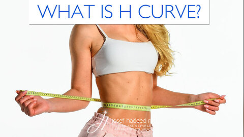 What is H-Curve? Rib Remodeling